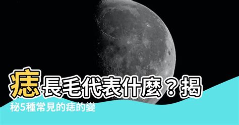 手臂痣長毛代表什麼|痣形成的原因？痣長毛、痣變多變大是痣病變？5招判。